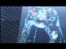 Melanchly of Haruhi AMV Melanchly of Haruhi AMV