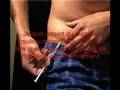 DIABETE