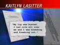 Girl Injured At Theme Park Describes Incident