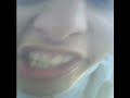 Thumbnail #3