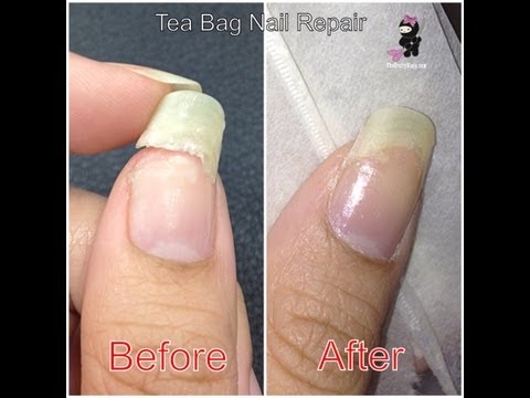 how to fix a broken nail