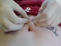 Stomach Surface Piercing Stomach Surface Piercing