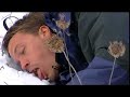 The Effects of Hypothermia The Effects of Hypothermia
