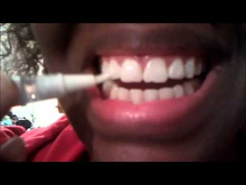 how to whiten a dead tooth