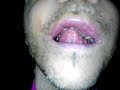 The music will come later. The grey catfood looking crap is the new cloned material also it looks fleshy. First surgery two years ago removed the fist sized malignant tumor,upper jaw, & from my head