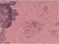Ciliated protozoo