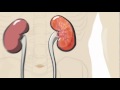 Kidney Intervention - What To Expect From the Robotic-Assisted Method Kidney Intervention - What To Expect From the Robotic-Assisted Method