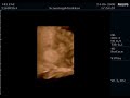 Scanning
