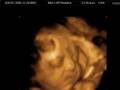 videos de Our Little Abby