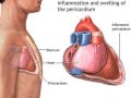 The Chest