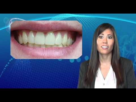 how to whiten teeth in adobe photoshop elements 10