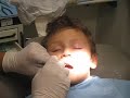 dormire dal dentista