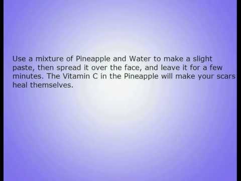how to get rid of spots in 24 hrs