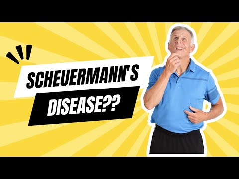 how to cure scheuermann's kyphosis
