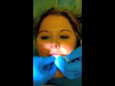 how to cure mouth cancer