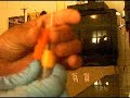 phlebotomy