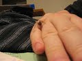 My G. Rosea Sling