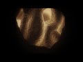 KURU - Prions (Progr
