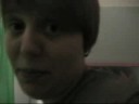 Its Getting Close-scaring Aaris