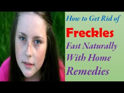 video-linktoworks-How to Get Rid of Freckles On Face Fast Naturally...
