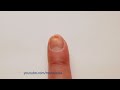 Nail It - time lapse Damaged nail growing timelapse.