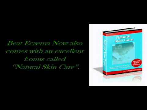 how to naturally beat eczema