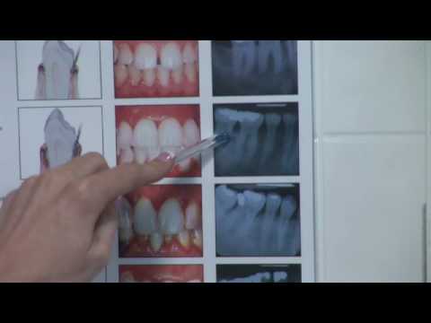 how to cure bad breath ehow