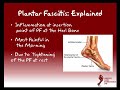 Plantar Fasciitis Explained