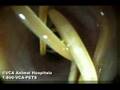 Roundworm inside cat's intestine