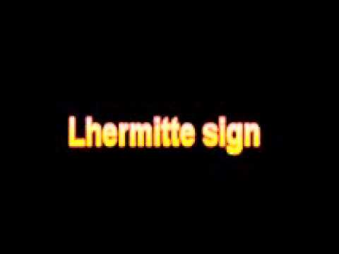 how to perform lhermitte's sign