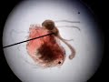 Hydra Eating Daphnia