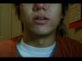 The Acne Practice (2009 Rebate Offer) The Acne Practice (2009 Rebate Offer)