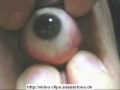 Auge Achtung Auge Achtung