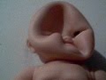 deformed-baby