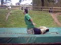 Dislocated shoulder accident trampolene