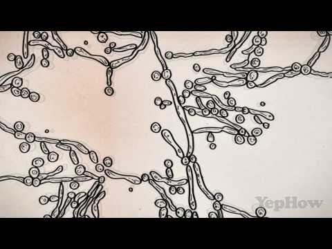 how to self cure yeast infections