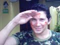 Soldado Ferido
