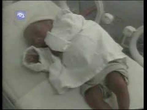 Baja de la mortalidad infantil y ...