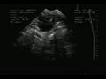 K�peklerde Gebelik Ultrasonografisi-2