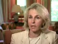 Life With VCFS Part 1 Velocardiofacial Syndrome