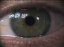 eye