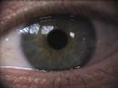 eye