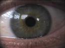 eye