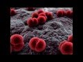 Click to View : Страшные инфекции, от которых не застрахован никто