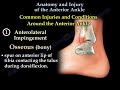 Ankle Pain Complete Overview - Everything You Need To Know - Dr. Nabil Ebraheim