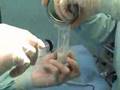 Artroplastia total de quadril em cães