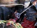 queloide equino queloide equino