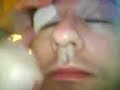 tonys eye brows waxed! OUCH!