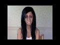 It Gets Better: Lizzie Velasquez