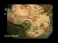 Sua Saúde Depende do Intestino